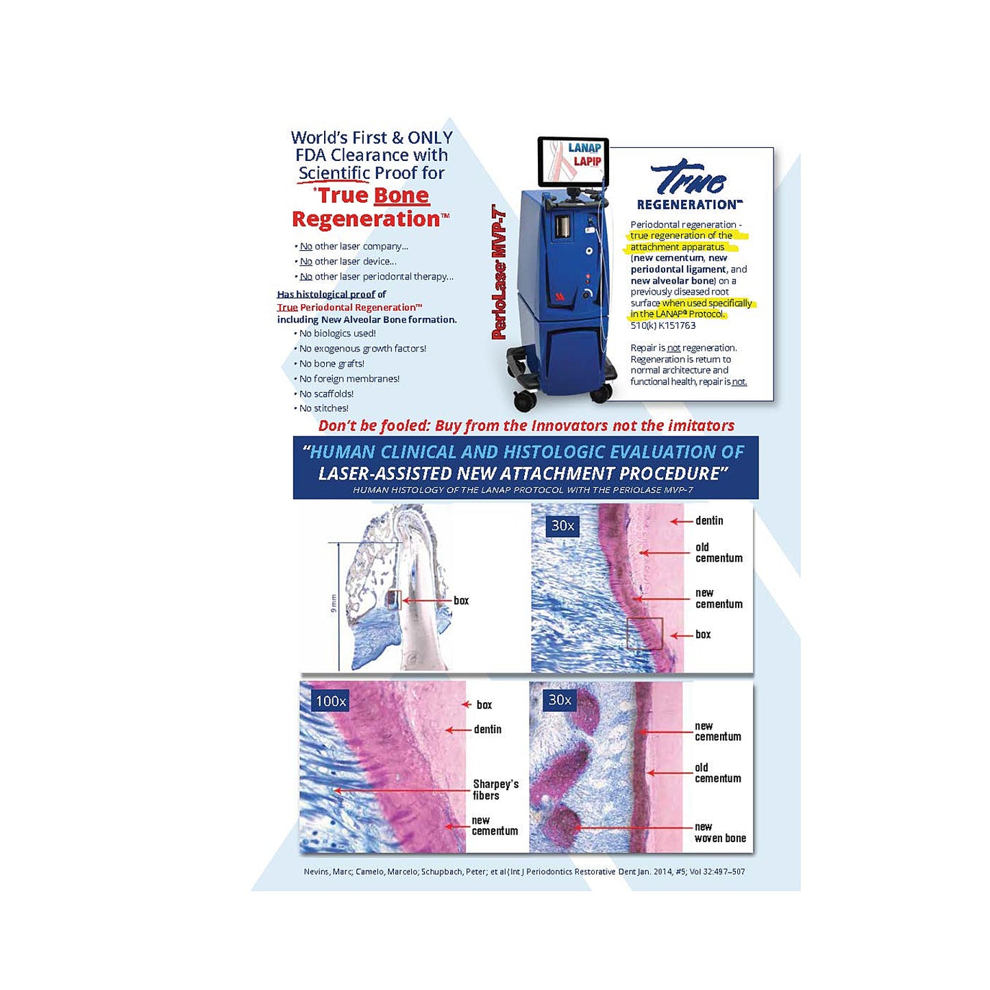 LANAP® Success Brochure - 25pk