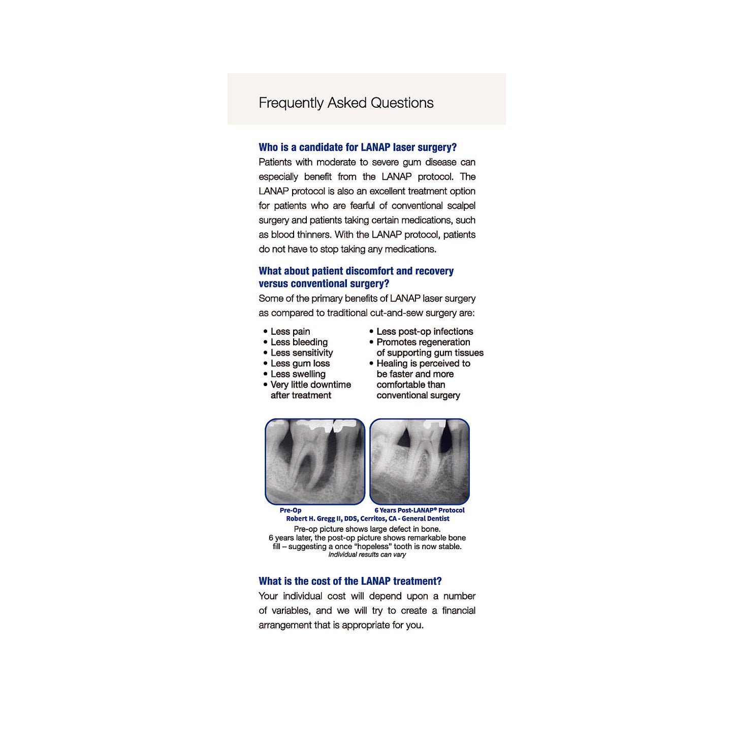 LANAP Protocol Patient Brochure - 25pk - ENGLISH/SPANISH