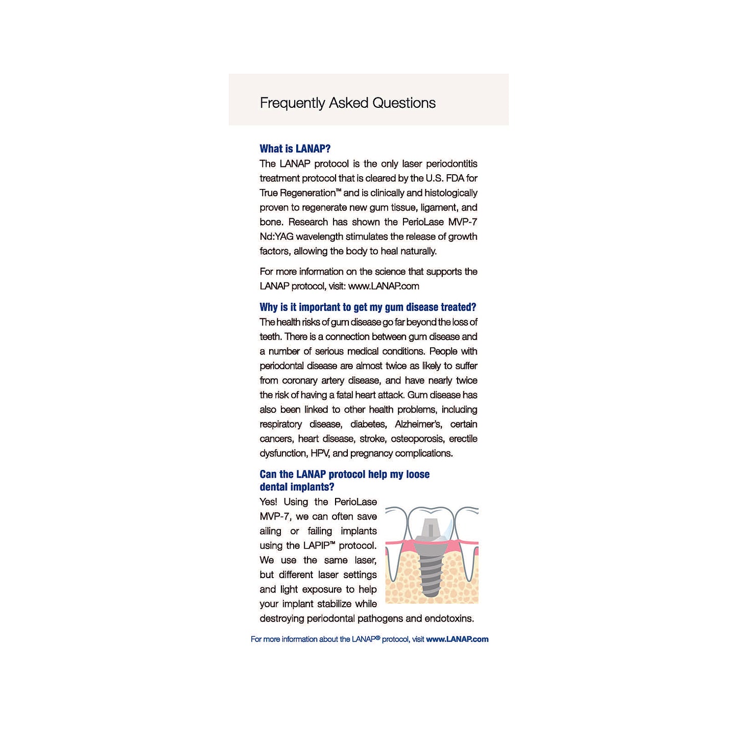 LANAP Protocol Patient Brochure - 25pk - ENGLISH/SPANISH