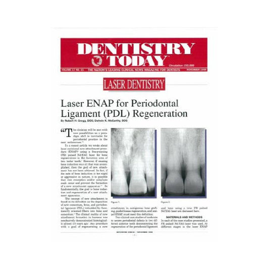 Reprint - Laser ENAP for Periodontal Ligament (PDL) Regeneration - Dentistry Today - 25pk