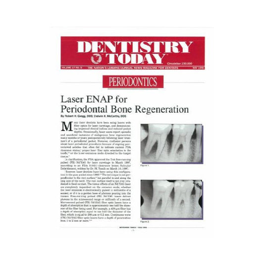 Reprint - Laser ENAP for Periodontal Bone Regeneration - Dentistry Today - 25pk