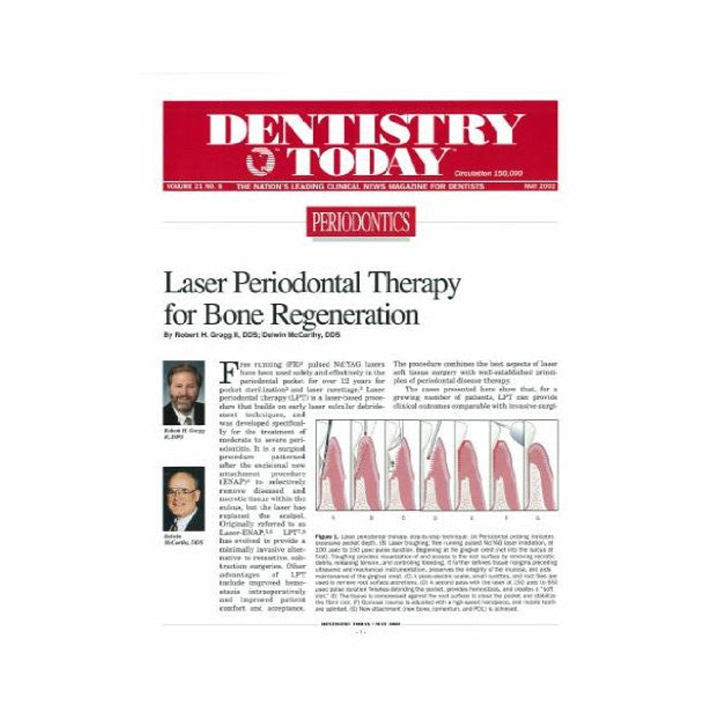 Reprint - Laser Periodontal Therapy for Bone Regeneration: Eight Year Retrospective Review of Laser Periodontal Therapy in Private Practice - Dentistry Today - 25pk