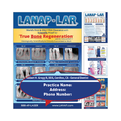 LANAP® Success Brochure - Custom - 100pk