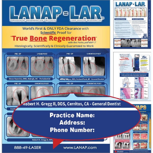 LANAP® Success Brochure - Custom - 100pk