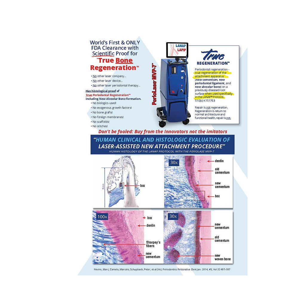 LANAP® Success Brochure - 25pk – Millennium Dental Technologies, Inc.