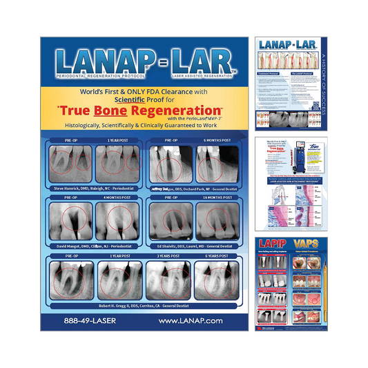 LANAP® Success Brochure - 25pk