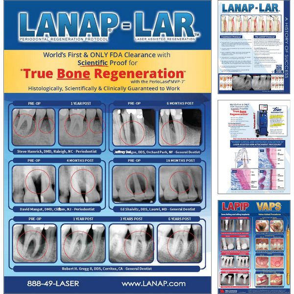 LANAP® Success Brochure - 25pk