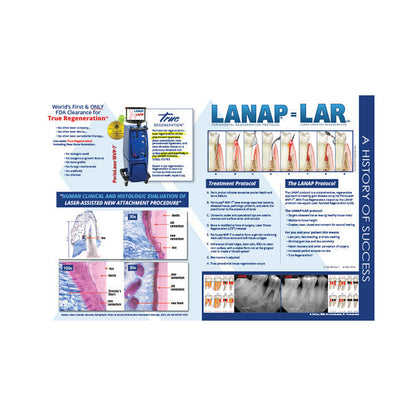 LANAP® Success Brochure - Custom - 100pk